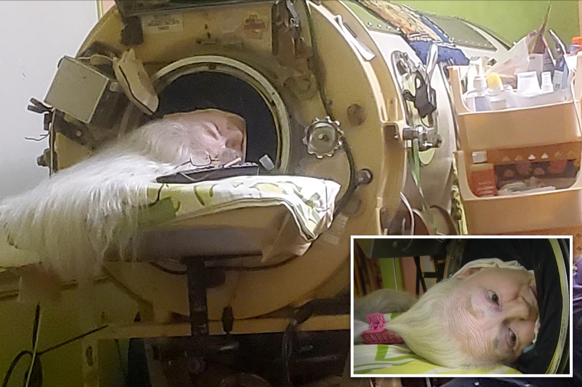 The Last Iron Lung Patient's Remarkable Journey Ends