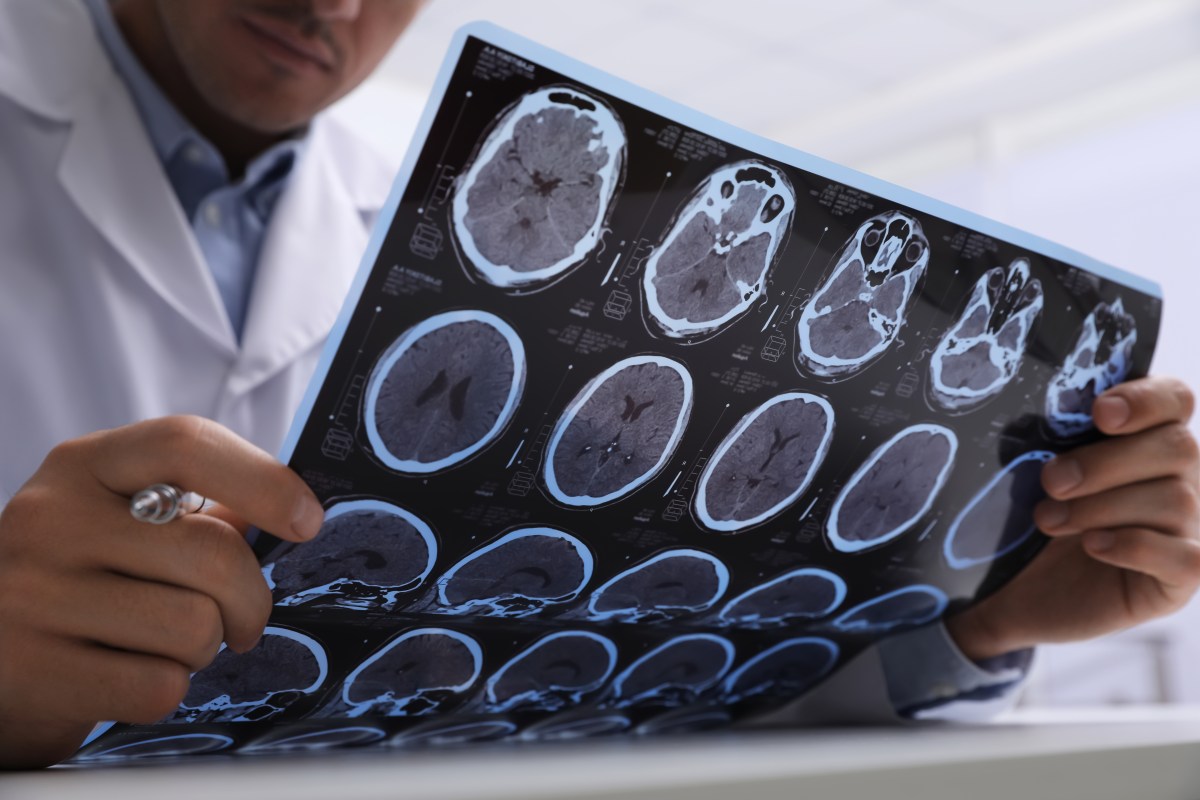 This Childhood Diet Secret Could Change Your Brain's Future